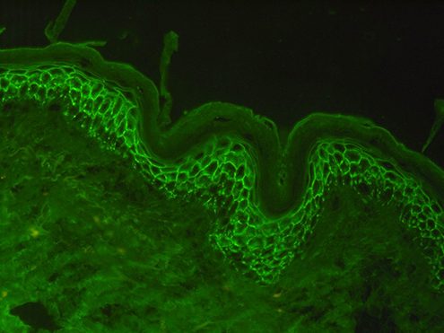 Direkte Immunfluoreszenz